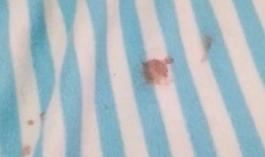 (VIDEO) Residencia sanitaria Hotel Termas de Panimávida: denuncian sábanas con sangre y presencia de arañas de rincón