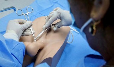 La vasectomía: romper barreras de género en la planificación familiar