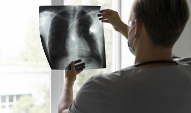 Enfermedad Pulmonar Obstructiva Crónica: cuáles son sus causas y riesgos