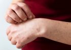 Alerta sanitaria por sarampión: ¿Quiénes deben vacunarse?
