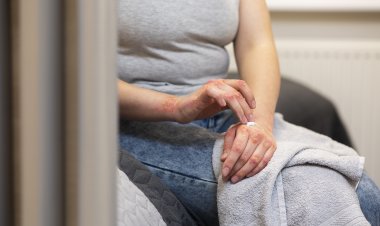 ¿Qué es la sífilis?: Preocupa el aumento en tasa de contagio en personas mayores