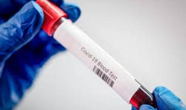 Linares sumó 7 casos de Covid-19